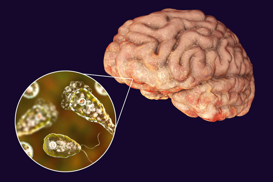 Brain-Eating Amoeba