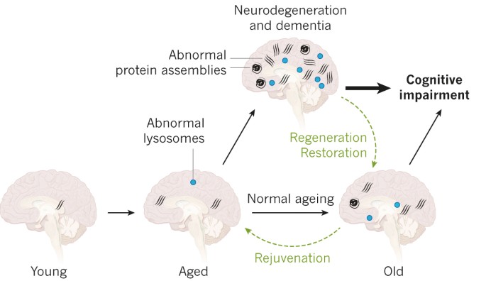 Brain Aging